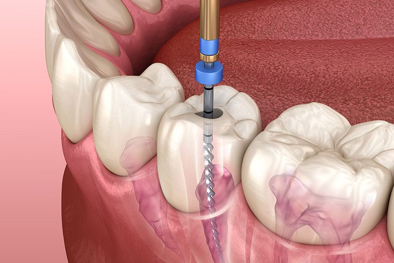 FATHIMA DENTAL CLINIC KIZHISSERI