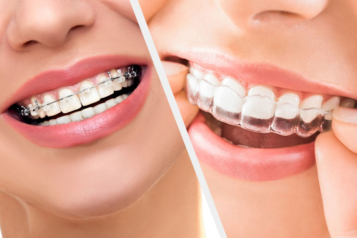 FATHIMA DENTAL CLINIC KIZHISSERI