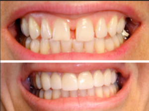 FATHIMA DENTAL CLINIC KIZHISSERI