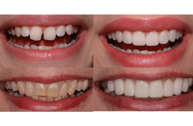 FATHIMA DENTAL CLINIC KIZHISSERI